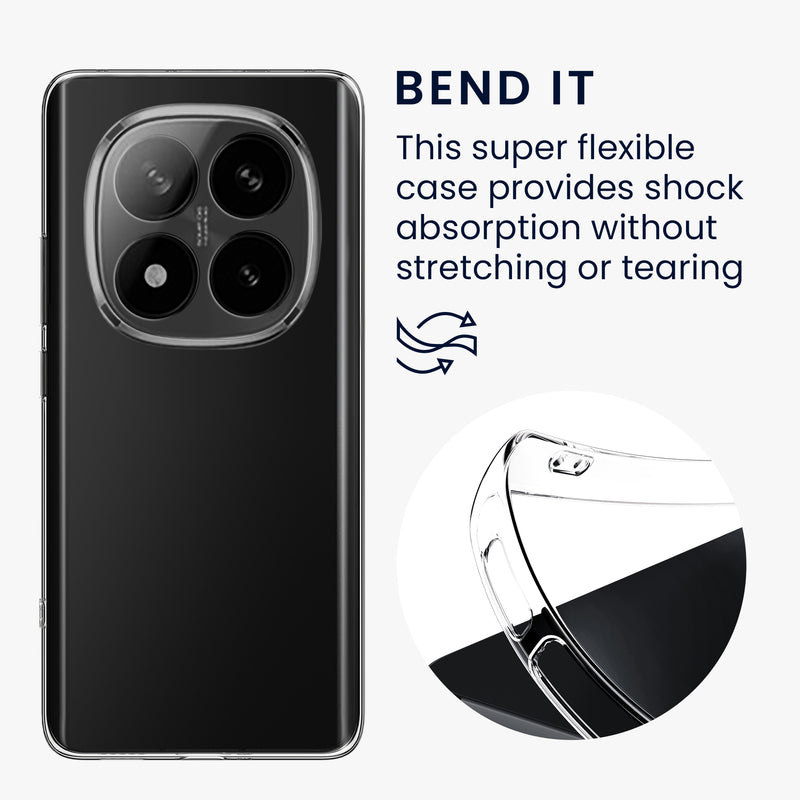 kwmobile Case Compatible with Xiaomi Redmi Note 14 Pro+ 5G / Redmi Note 14 Pro Plus 5G