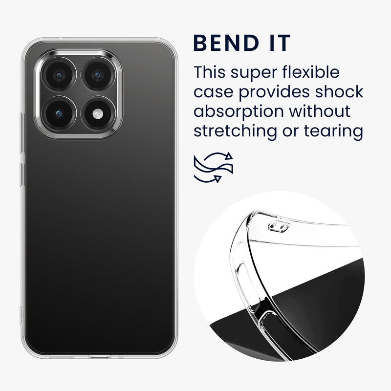 kwmobile Case Compatible with Xiaomi 15T